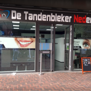 De-tandenbleker-amsterdam-buitenkant-1